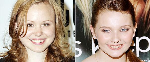 Abigail Breslin and Alison Pill to Star in The Miracle Worker on Broadway